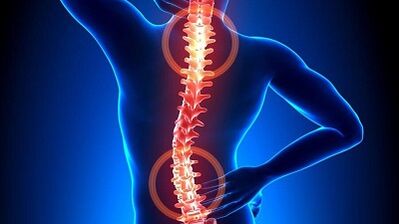 Mechanismus der Entwicklung von Osteochondrose