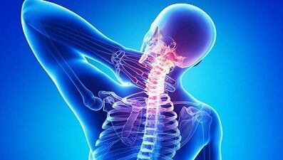 Wie sich Osteochondrose äußert
