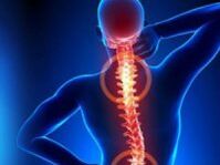 Rückenturnen bei Osteochondrose