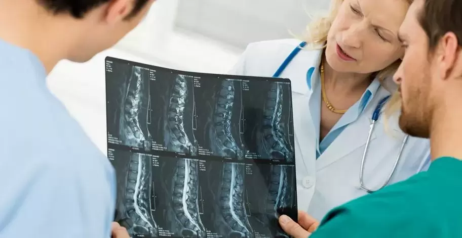 Diagnose von Osteochondrose der Brustregion